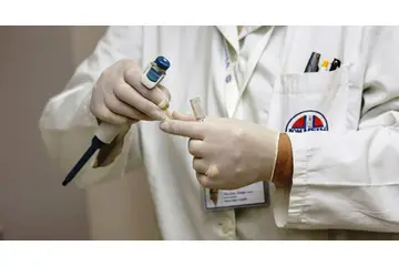 Siğil Nedir? Siğil Belirtileri ve Tedavisi